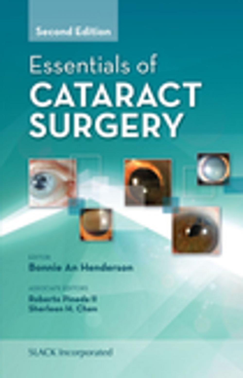 Big bigCover of Essentials of Cataract Surgery, Second Edition