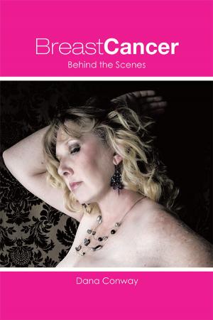 Cover of the book Breast Cancer by IRENE GUTIERREZ