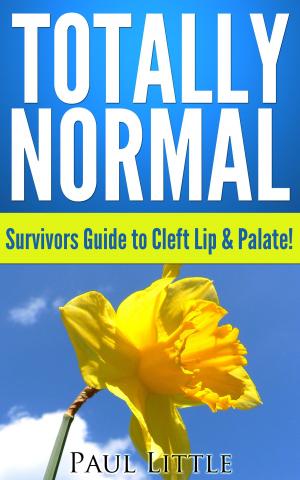 Cover of the book Totally Normal: Survivors Guide to Cleft Lip & Palate by Howard Breeze