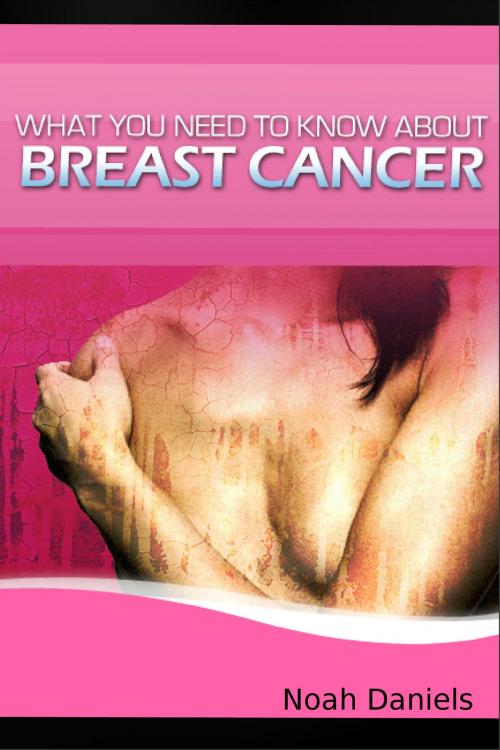 Cover of the book What You Need to Know About Breast Cancer by Noah Daniels, wolfmedia2000