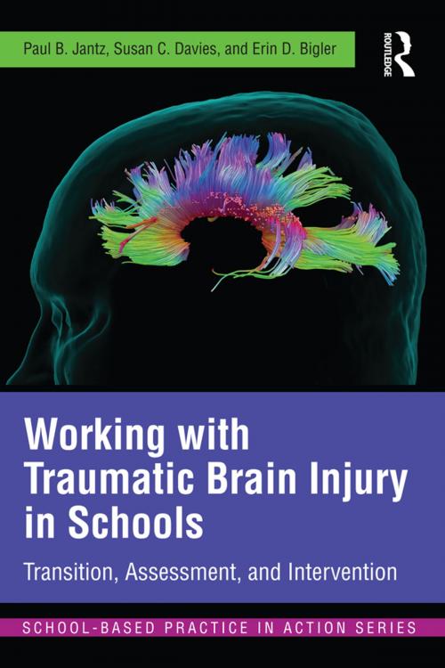 Cover of the book Working with Traumatic Brain Injury in Schools by Paul B. Jantz, Susan C. Davies, Erin D. Bigler, Taylor and Francis