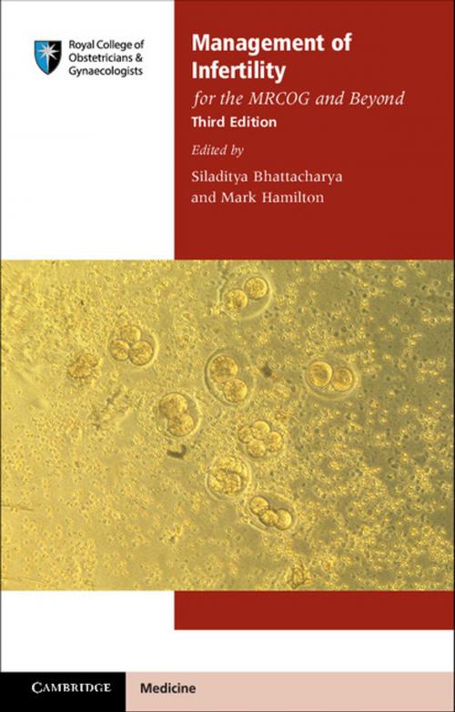 Cover of the book Management of Infertility for the MRCOG and Beyond by , Cambridge University Press