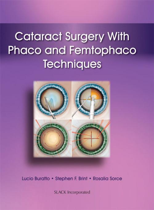 Cover of the book Cataract Surgery With Phaco and Femtophaco Techniques by , SLACK Incorporated
