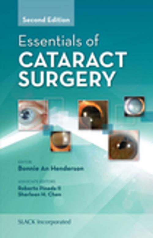 Cover of the book Essentials of Cataract Surgery, Second Edition by , SLACK Incorporated