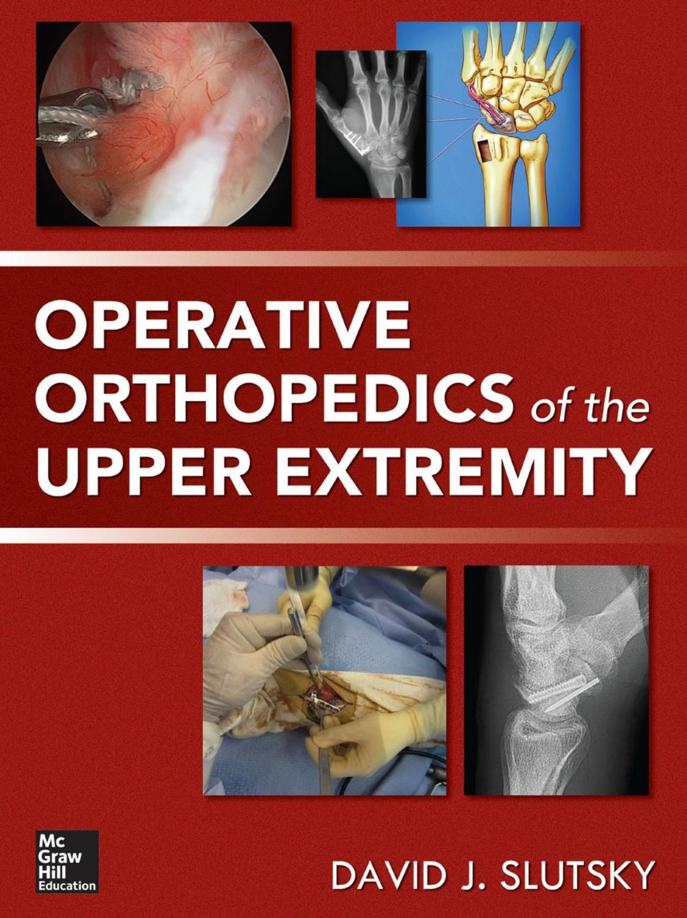 Big bigCover of Operative Orthopedics of the Upper Extremity