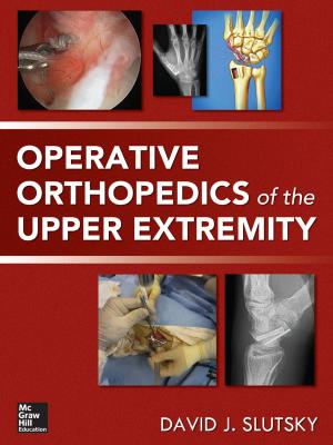Cover of the book Operative Orthopedics of the Upper Extremity by John Tjia