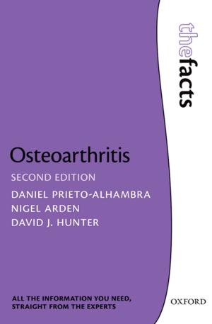 Book cover of Osteoarthritis: The Facts