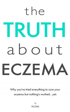 Cover of the book The Truth About Eczema by Francisco Alcaina