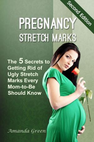 Cover of the book Pregnancy Stretch Marks: The 5 Secrets to Getting Rid of Ugly Stretch Marks Every Mom-to-Be Should Know by LUIGI DEL BUONO