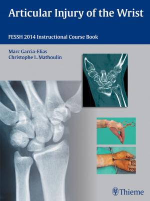 Cover of the book Articular Injury of the Wrist by Christof Sohn, Klaus Vetter, Hans-Joachim Voigt