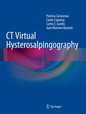 Book cover of CT Virtual Hysterosalpingography