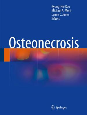 Cover of the book Osteonecrosis by Otto Sandrock, Claus Luttermann, Matthias Casper, Jean J. du Plessis, Ingo Saenger, Bernhard Großfeld