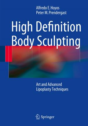 Cover of the book High Definition Body Sculpting by Alison S. Tomlin, Tamás Turányi