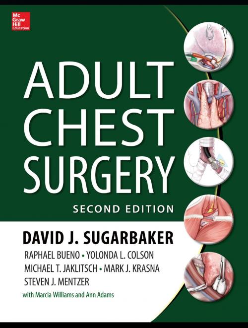 Cover of the book Adult Chest Surgery, 2nd edition by Yolanda Colson, Michael Jaklitsch, David J. Sugarbaker, Raphael Bueno, Mark J. Krasna, Steven Mentzer, McGraw-Hill Education