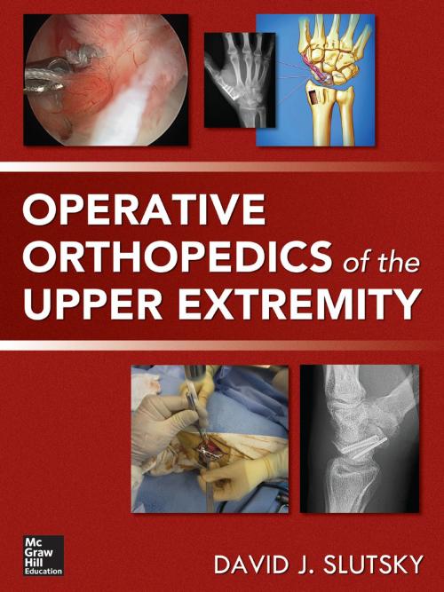 Cover of the book Operative Orthopedics of the Upper Extremity by David Slutsky, McGraw-Hill Education