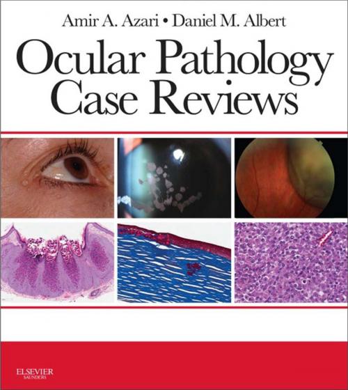 Cover of the book Ocular Pathology Case Reviews E-Book by Amir A. Azari, MD, Daniel M. Albert, MD, MS, Elsevier Health Sciences