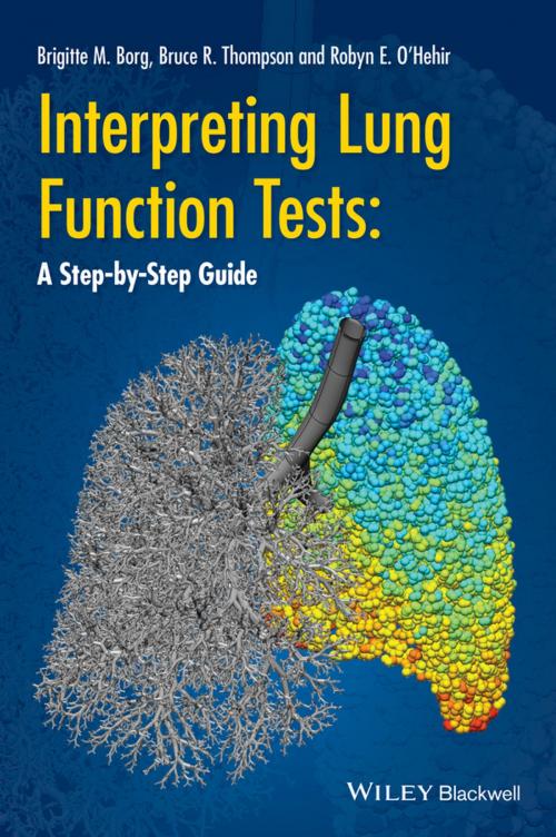 Cover of the book Interpreting Lung Function Tests by Bruce R. Thompson, Brigitte M. Borg, Robyn E. O'Hehir, Wiley