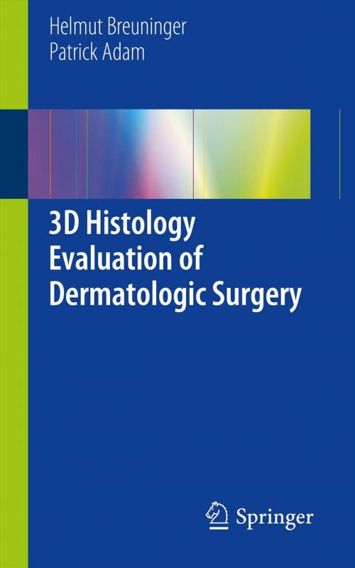 Cover of the book 3D Histology Evaluation of Dermatologic Surgery by Helmut Breuninger, Patrick Adam, Springer London