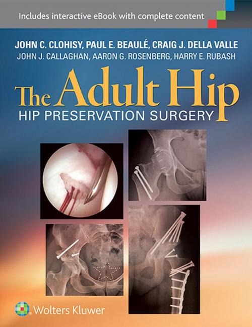 Cover of the book The Adult Hip by John Clohisy, Paul Beaule, Craig DellaValle, John J. Callaghan, Aaron G. Rosenberg, Harry E. Rubash, Wolters Kluwer Health