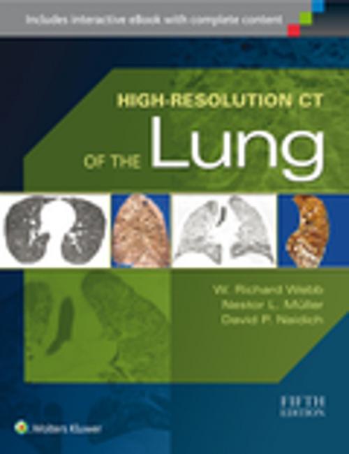 Cover of the book High-Resolution CT of the Lung by W. Richard Webb, Nestor L. Muller, David P. Naidich, Wolters Kluwer Health