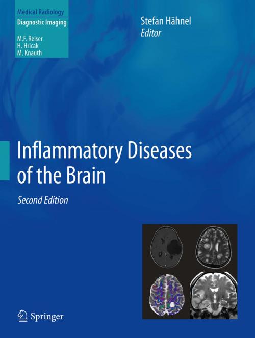 Cover of the book Inflammatory Diseases of the Brain by , Springer Berlin Heidelberg