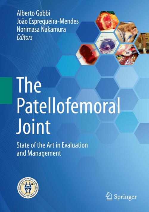 Cover of the book The Patellofemoral Joint by , Springer Berlin Heidelberg