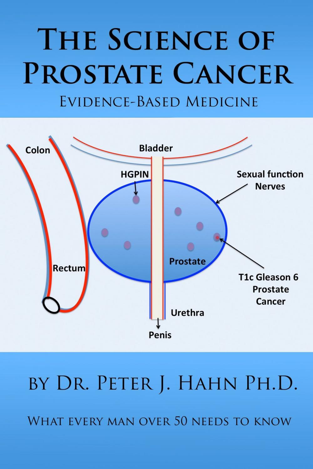 Big bigCover of The Science of Prostate Cancer