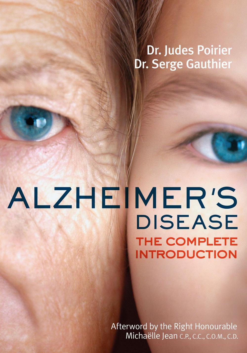Big bigCover of Alzheimer's Disease