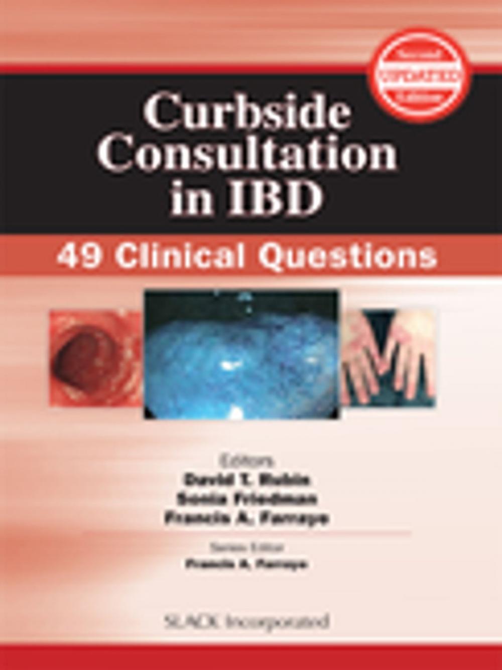Big bigCover of Curbside Consultation in IBD