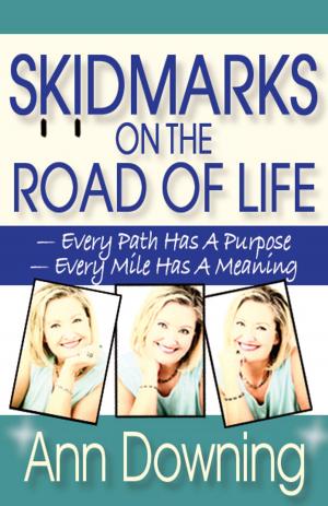 Cover of the book Skidmarks on the Road of Life by Benny Hinn
