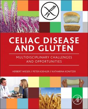 Cover of the book Celiac Disease and Gluten by Yoshinobu Tanaka