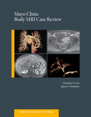 Book cover of Mayo Clinic Body MRI Case Review