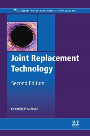 Cover of the book Joint Replacement Technology by Spyros G Tzafestas