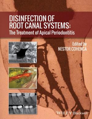 Cover of the book Disinfection of Root Canal Systems by Jim Coulson