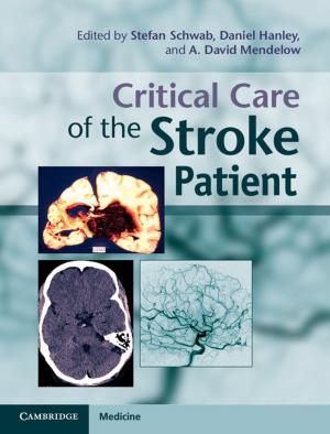 Cover of the book Critical Care of the Stroke Patient by Colin Kidd