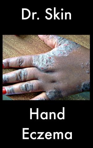 Cover of the book Hand Eczema by Dr Skin