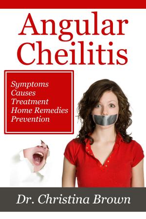 Book cover of Angular Cheilitis