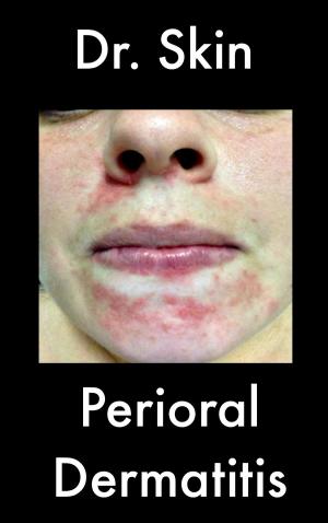 Cover of the book Perioral Dermatitis by Dr Skin