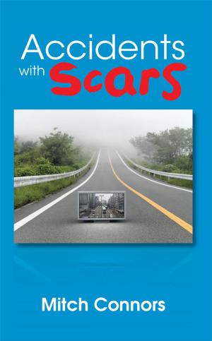 bigCover of the book Accidents with Scars by 