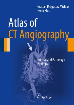 Cover of the book Atlas of CT Angiography by Yihui Wang, Bin Ning, Ton van den Boom, Bart De Schutter