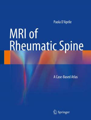 Cover of the book MRI of Rheumatic Spine by Agnieszka Daniszewska