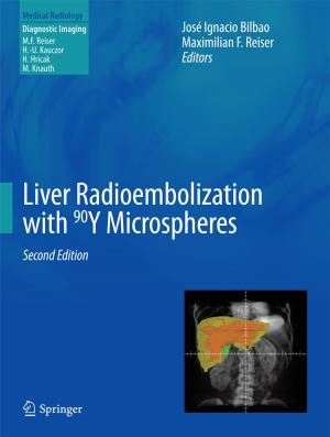 Cover of the book Liver Radioembolization with 90Y Microspheres by Jean M. Rüeger