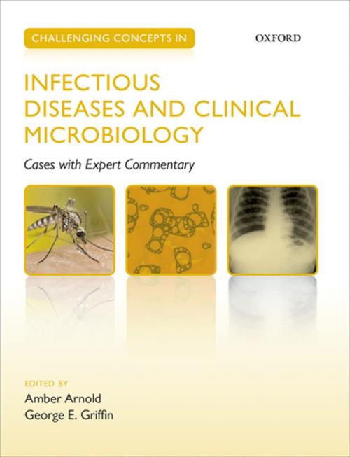 Cover of the book Challenging Concepts in Infectious Diseases and Clinical Microbiology by , OUP Oxford