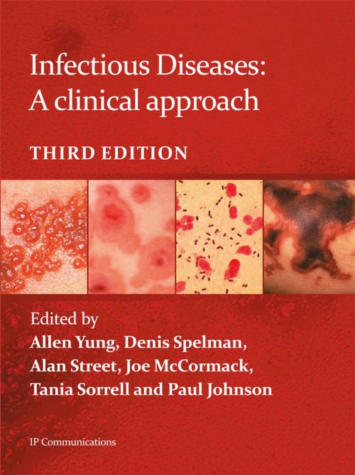 Cover of the book Infectious Diseases: A clinical approach by Allen Yung, Denis Spelman, Alan Street, IP Communications
