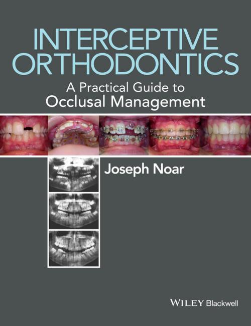 Cover of the book Interceptive Orthodontics by Joseph Noar, Wiley