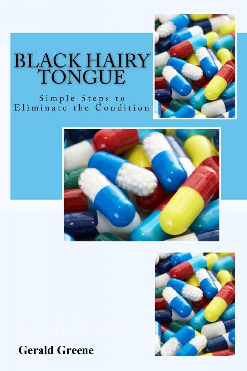 Cover of the book Black Hairy Tongue: Simple Steps to Eliminate the Condition by Gerald Greene, Andale LLC