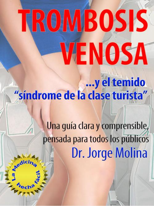Cover of the book Trombosis Venosa by Jorge Molina, Jorge Molina