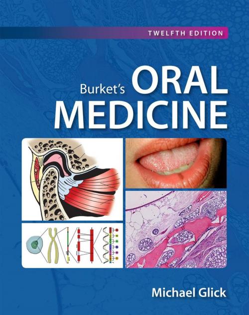 Cover of the book Burket's Oral Medicine, 12e by Michael Glick, PMPH USA, Ltd.