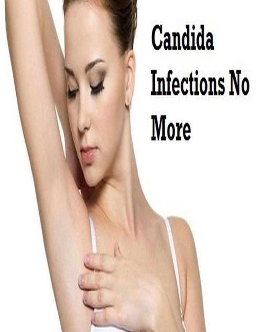 Big bigCover of Candida Infections No More