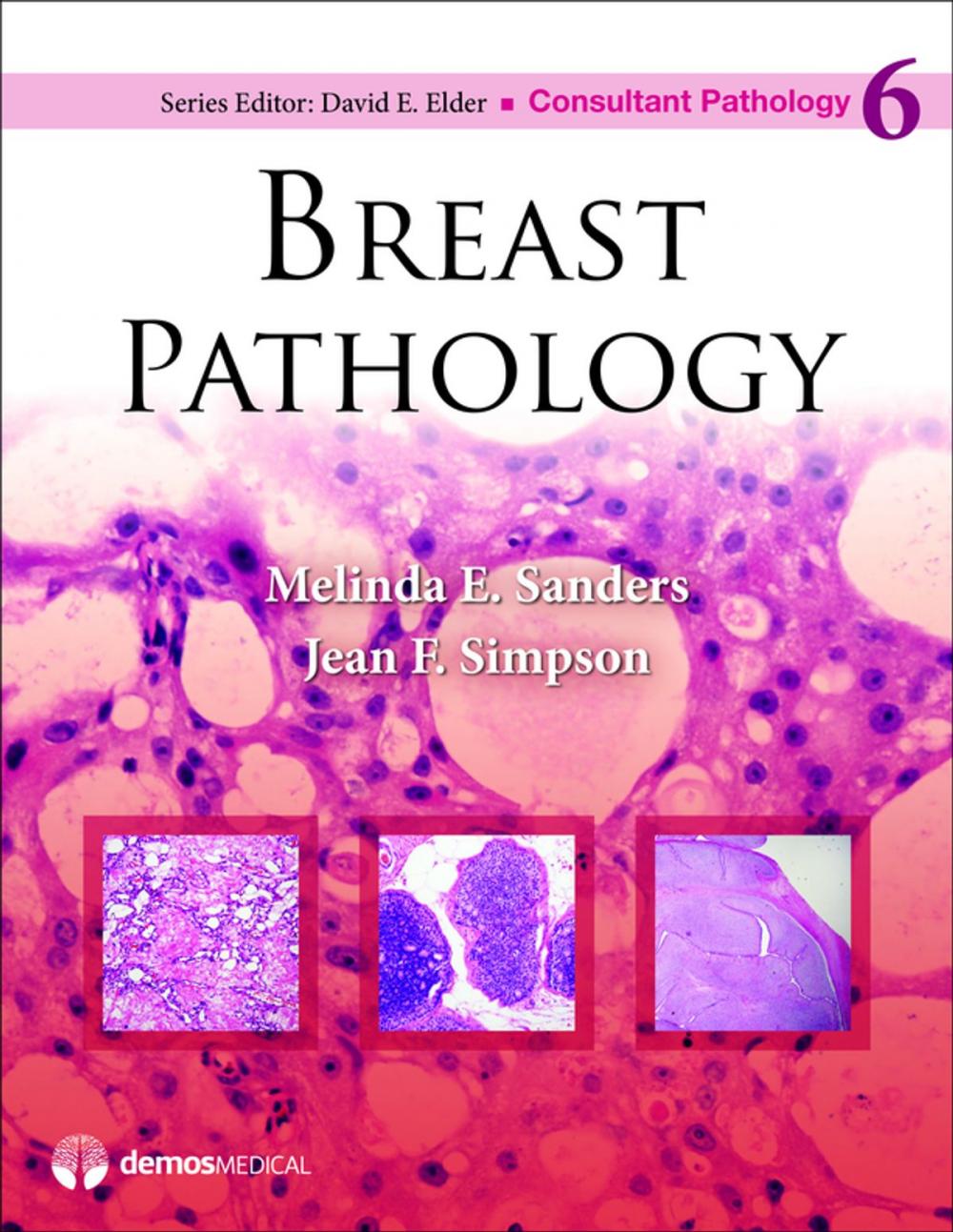 Big bigCover of Breast Pathology